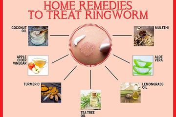 Ringworm Pada Manusia Dapat Diatasi Dengan 7 Bahan Alami Ini