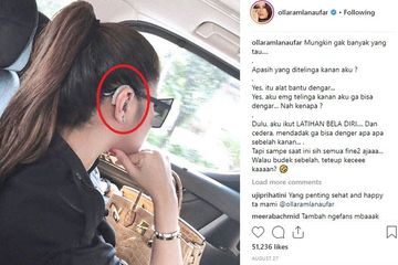 Olla Ramlan Tuli Sebelah Kanan, Ini Penyebab dan Cara Penyembuhannya