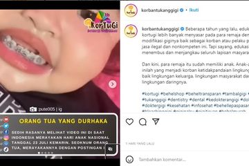Viral Balita Dipakaikan Behel ke Giginya, Apakah Diperbolehkan?