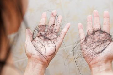 Penyebab rambut rontok parah yang sering dialami 