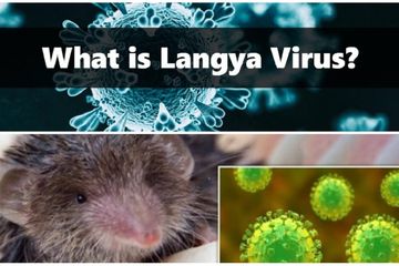 Virus Langya, virus baru dari Cina yang diduga berasal dari hewan pengerat, tikus.