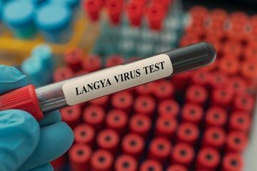 Menkes Budi; Virus Langya Masih Terlalu Dini Untuk Indonesia, Masih di Timur China