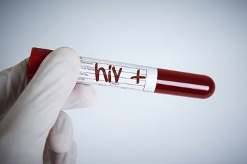 Beginilah kisah nyata penyintas HIV aids yang akhirnya dinyatakan sembuh 