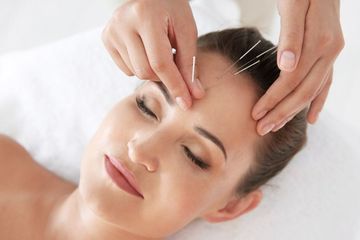 Cara mengobati insomnia dengan teknik akupunktur.