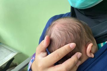 Pilihan yang aman obat demam bayi usia 0-6 bulan yang tersedia di apotik.