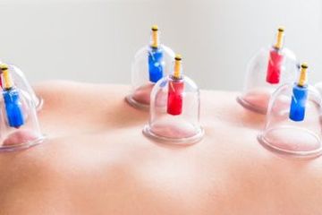  Manfaat Bekam Bagi Penyandang Hipertensi, Atasi dengan Cepat!