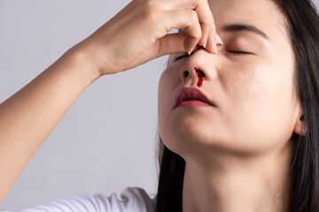 Mimisan Bisa Merupakan Gejala Kanker Nasofaring yang Membahayakan