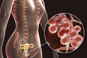 Inilah jenis-jenis penyakit infeksi vagina dan gejalanya yang membahayakan, wanita wajib berhati-hati.