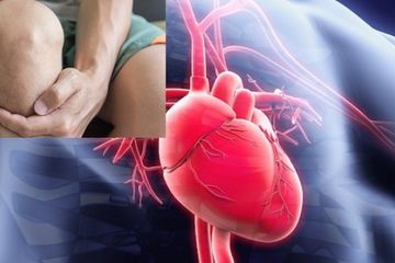 Bahaya asam urat bisa menyebabkan penyakit jantung hingga penyakit lainnya, kenali dan jangan sepelekan.