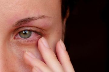 Penyakit mata seperti konjungtivitis atau mata merah dapat menular melalui benda yang dipakai bersama.