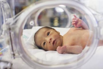 Hari Prematur Sedunia, Bayi Lahir Prematur Tumbuh Kembangnya Perlu Dipantau Hingga Dewasa