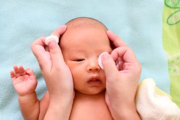 Penyakit Mata Merah Pada Bayi Disertai Kelopak Bengkak, Begini Cara Mengatasinya