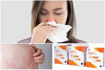 Pejuang alergi yang memiliki gejala seperti pilek alergi dan biduran, inilah daftar pilihan obat alergi yang wajib dibawa.