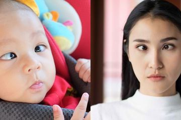 Mata juling pada anak dan orang dewasa, membuat pandangan mata tidak fokus.