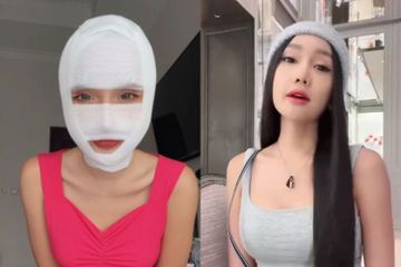  Kenali risiko yang terjadi saat sering melakukan operasi plastik seperti Lucinta Luna.