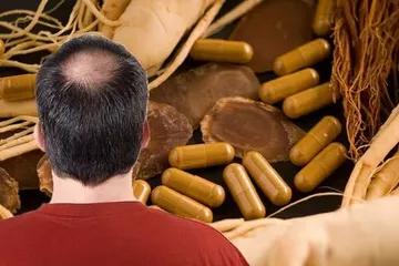 Mengatasi Rambut Rontok dengan Ramuan Herbal, Terhindar dari Kebotakan