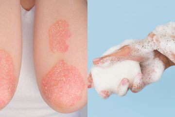 Pilihan sabun untuk pengidap psoriasis yang dapat melembabkan dan tidak mengandung bahan iritan.