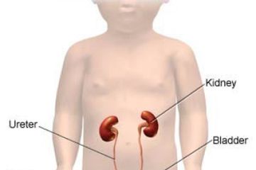 Jangan sampai terlambat, bahaya sakit ginjal pada anak dan cara menanganinya.