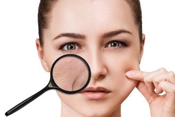 Cara Efektif Mengatasi Kulit Kering dan Kusam Agar Kulit Wajah Cerah Kembali!