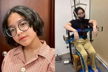 Seperti Ini Penanganan Skoliosis Pada Anak, Sempat Dirasakan oleh Putri Uya Kuya hingga Merasa Minder - Semua Halaman - Grid Health