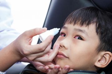 Pengobatan penyakit mata merah sangat disesuaikan dengan penyebabnya, inilah beberapa penyebab umum dan jangan asal kasih obat.