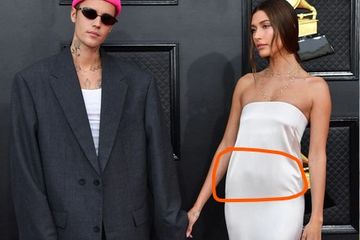 Hailey Bieber mengidap kista ovarium, ini yang harus dilakukannya untuk kesehatannya.