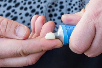 Ini Dia Obat Kapalan di Jari yang Bagus, Tersedia di Apotek