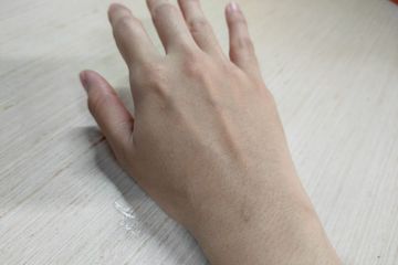 mengatasi tangan gatal, bintik, dan berair