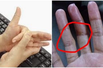 Jangan biasakan kretek-kretek jari alias membunyikan persendian jari, berbahaya.
