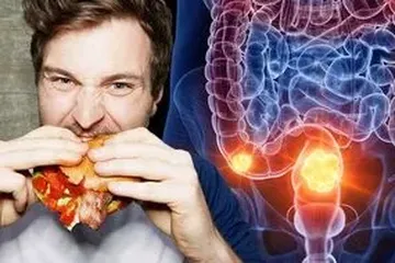 Hati-hati Pekerja Shift Malam Berisiko Mengalami Kanker Usus