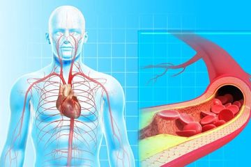 Berikut ini 7 tips sehat melancarkan sirkulasi peredaran darah, yang bisa bantu cegah penyakit jantung.