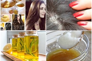 Cara Hilangkan Ketombe Dengan Bahan Alami Ini, Serpihan Putih Hilang Rambut Berkilau