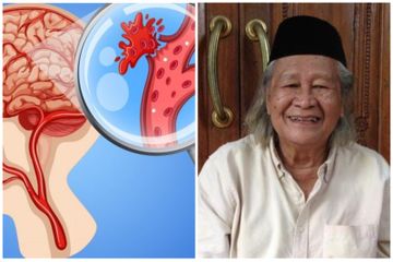 Ridwan Saidi meninggal akibat pecah pembuluh darah di otak, kenali deretan penyakit pemicu dan cara mencegahnya.
