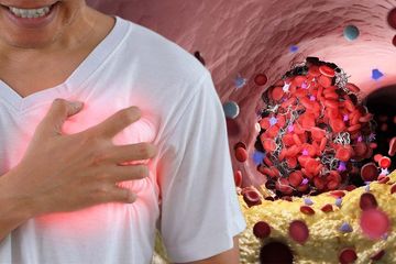 Sejak Pertama Kali Nyeri Dada Langsung ke Dokter, Hindari 5 Pemicu Jantung Koroner