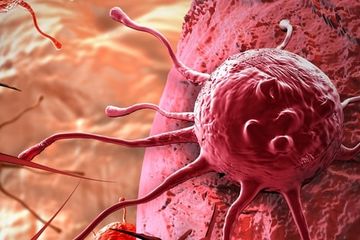 Kenali perbedaan kanker usus dengan tumor usus berikut ini.