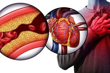 9 Orang yang Berpotensi Terkena Penyakit Jantung Koroner, Anda Termasuk Salah Satunya?