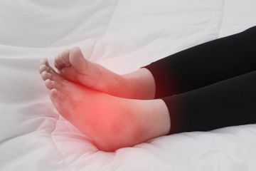 Inilah penyebab kaki bengkak akibat asam urat  