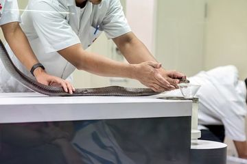 Daftar 11 Rumah Sakit di Jakarta yang Memiliki Serum Anti Bisa Ular, Tidak Semua RS Punya, Kenapa?