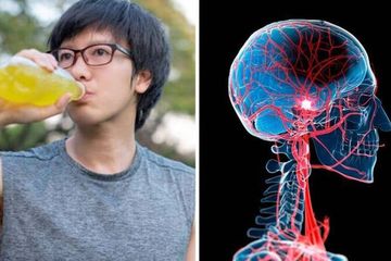 Penyebab Aneurisma Otak, Sering Konsumsi Minuman Mengandung Gula dan Minuman Berenergi