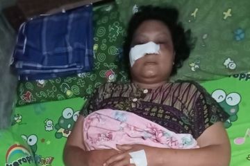 Korban klitih harus pulang karena tidak dijamin JKN, kenali berikut ini daftar pelayanan yang tidak dijamin JKN.