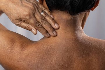 Kulit menggelap tanda diabetes terjadi di lipatan.