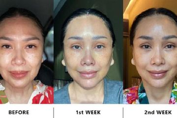 Unggahan Titi DJ sebelum dan setelah operasi anti aging.