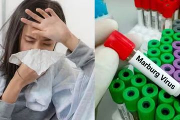 Berikut ini gejala terinfeksi virus Marburg, bisa fatal jika tidak ditangani dengan baik.