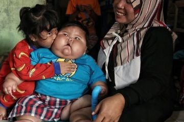 Bidan di Bekasi Temukan Bayi Raksasa, Usia 16 Bulan Berat Badannya 26,9 kilogram, Tidak ASI