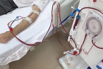 Berikut ini persiapan cuci darah bagi penyintas gagal ginjal, ketahui apa saja yang perlu dilakukan.
