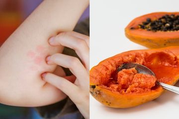 Pepaya termasuk bahan alami untuk kurap yang bisa digunakan dengan cara digosokkan ke kulit.