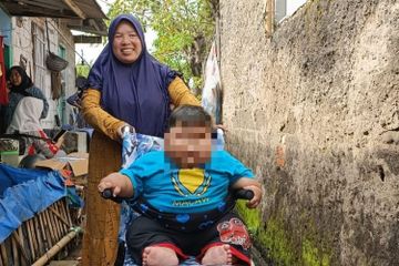 Balita di Bekasi mengalami obesitas, dan inilah bahaya yang bisa mengancam kesehatannya 