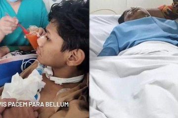 Kondisi terbaru David Ozora setelah tak sadarkan diri karena dianiaya oleh Mario Dandy.