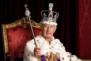 Resmi Dinobatkan Sebagai Raja Inggris, Jari Bengkak Pangeran Charles Kembali Jadi Pusat Perhatian, Ternyata Inilah yang Jadi Penyebabnya