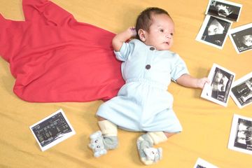 Apakah Moms sudah tahu beberapa penyebab BAB bayi 1 bulan berbusa? Moms bisa baca selengkapnya di sini beserta cara mengatasinya.